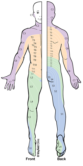 Figure 10, Illustration of dermatome pattern