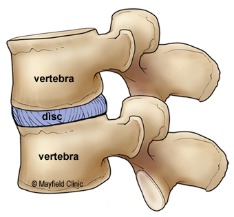Illustration, sideview of two intervertebral discs