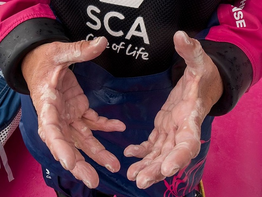 Вот так выглядят руки девушки после 18 дней в океане. Фото: Corinna Halloran/Team SCA/Volvo Ocean Race. 